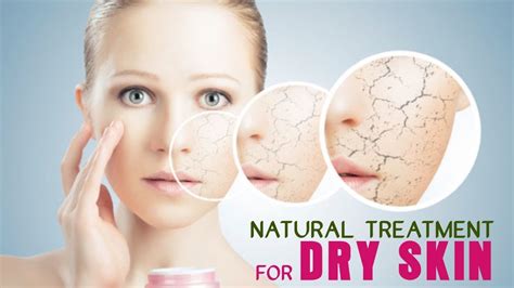 Natural Treatment Tips For Dry Skin Youtube