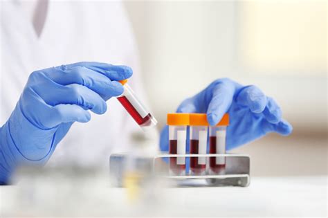 What To Expect During Your First Blood Test Precision Labs