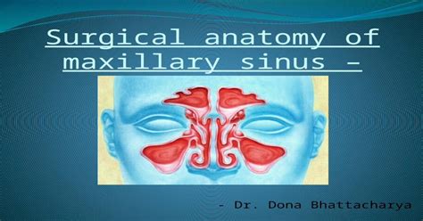 Surgical Anatomy Of Maxillary Sinus Note On 2 Pptx Powerpoint
