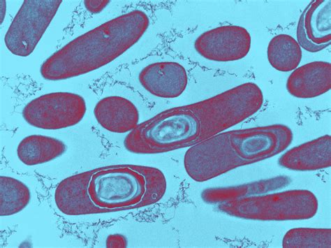 Symptoms include watery diarrhea, fever, nausea, and abdominal pain. Clostridium Difficile Bacteria, Tem Photograph by ...