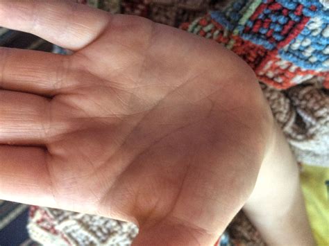 Autistic This Is The Palm Of A Young Girl Who Is Autistic Left Nawaz
