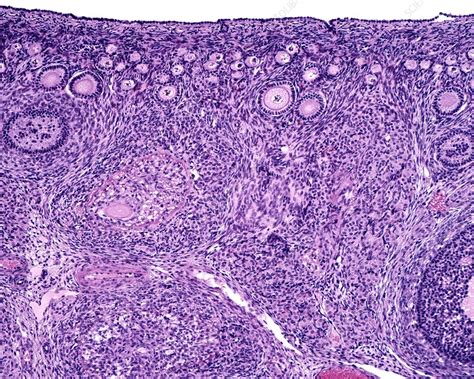 Ovarian Follicles Light Micrograph Stock Image C0456629 Science