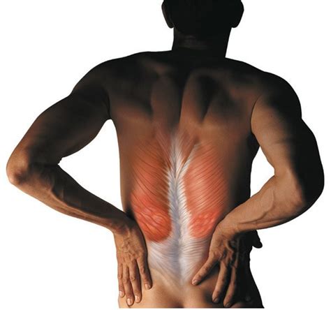 Unraveling The Connection Muscle Spasms And Secondary Lordosis