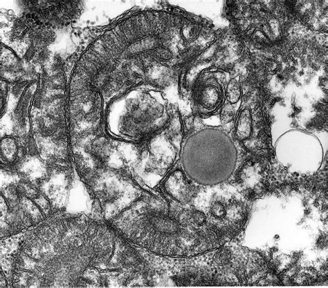 Neuropathology Blog Mister Mitochondrion