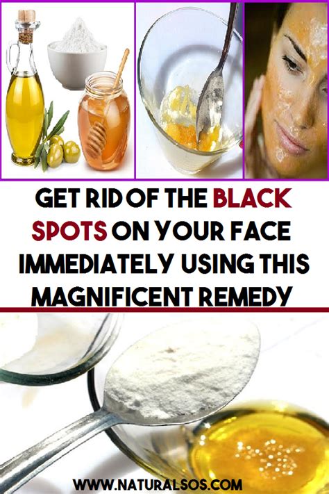 Get Rid Of The Black Spots On Your Face Immediately Using This