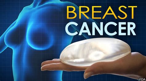Fda Approves An At Home Breast Cancer Treatment