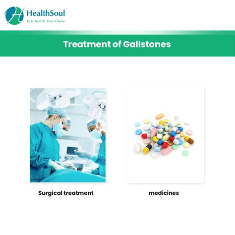 Gallstones Symptoms Diagnosis And Treatment Gastroenterology