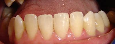 casos clinicos de estetica dental dentistas buenos aires