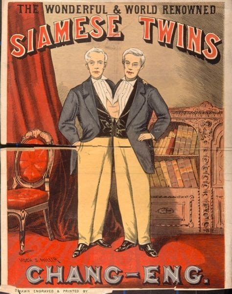 Siamese Twins Barnums Attractions Conjoined Twins Twins Circus Poster