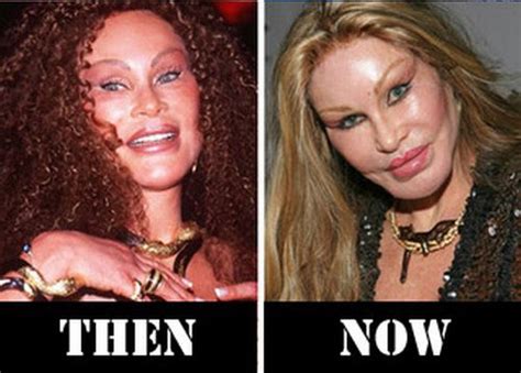 Catwoman Jocelyn Wildenstein Plastic Surgery Disaster Pictures
