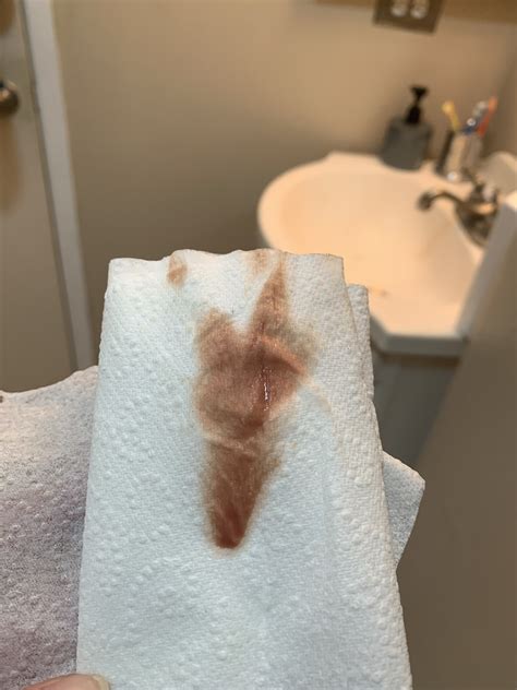 Implantation bleeding is a small amount of vaginal bleeding that can occur in early pregnancy due to the fertilized egg attaching to the inside of the uterus. *GRAPHIC PHOTO* is this implantation bleeding?