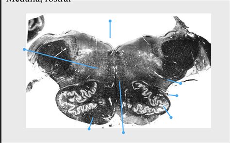 Medulla Rostral Diagram Quizlet