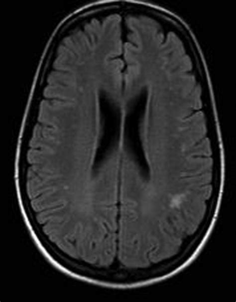 Shorts 10 025f1psychosis In A Young Female A Diagnostic And