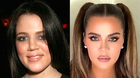 Khloe kardashian before and after photos. Khloe Kardashian's plastic surgery secrets revealed +pics