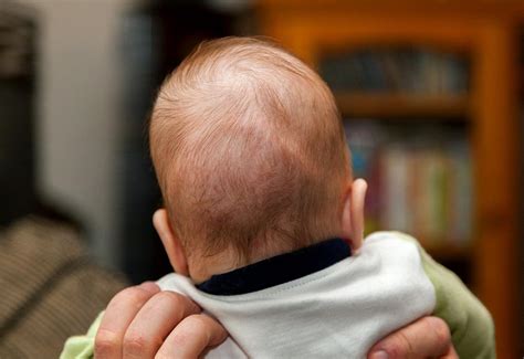 How To Cure Bump On Baby Backside Of The Head Firstcry