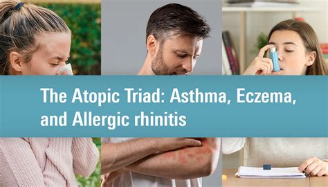 The Atopic Triad Asthma Eczema And Allergic Rhinitis