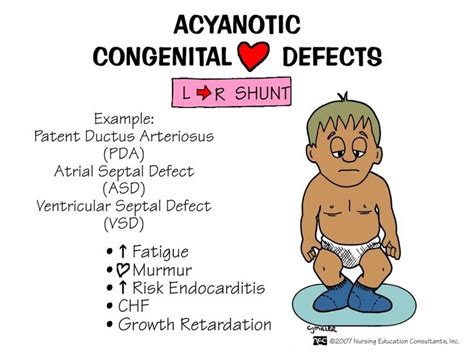 Congenital Heart Defects Tof Vsd Asd Pda Diagram Quizlet