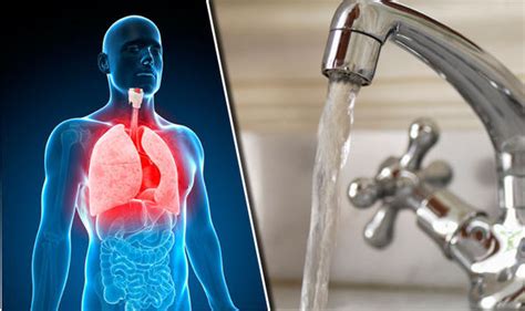 Legionella pneumonia, also known as legionnaires' disease, refers to pulmonary infection primarily with the organism legionella pneumophila. Holiday warning: Run your taps when you return home to ...