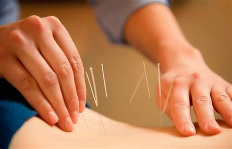 weight loss with acupuncture can acupuncture help you lose weight