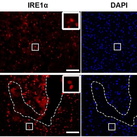 Representative Immunofluorescence Microphotographs Of Ire1α And