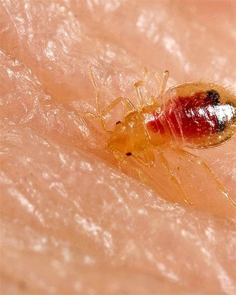 Whats Biting Me Being Eaten By Invisible Bugs In Your Home