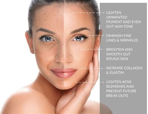 What Do Chemical Peels Do Dr Refresh Med Spa