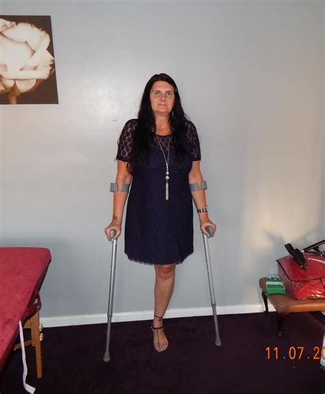 Sw10946346291 Amputee Crutches Cb777a Flickr