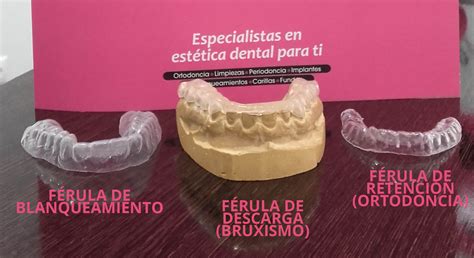 Check spelling or type a new query. férula de descarga | Instituto Carreres: Clínica dental ...
