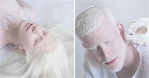 Photographer Yulia Taits Captured The Beauty Of Albino People