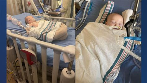 Utah Mom Warns Parents After Month Old Intubated With Rsv Youtube