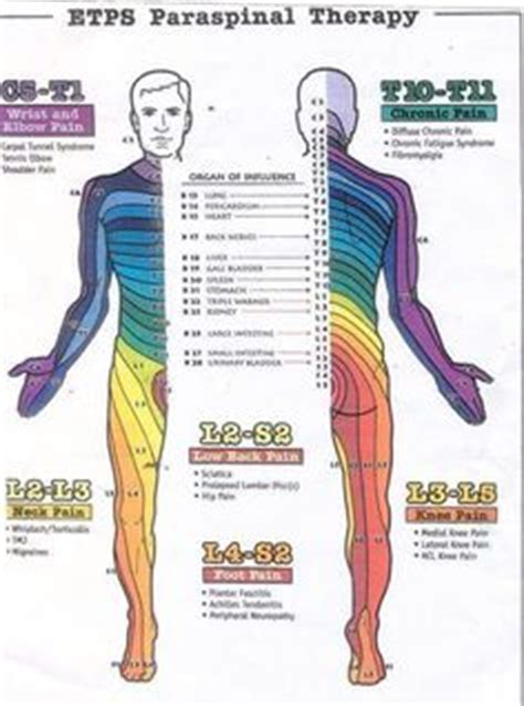 Sensory Dermatome Body Map At Radiculopathy Occupational Therapy