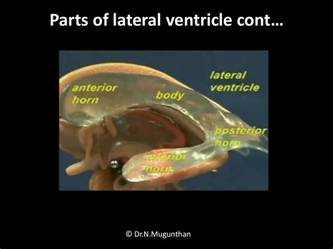 Lateral Ventricle Of Brain By Drnmugunthanms