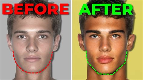 Avoid These 5 Mewing Mistakes For A Sharp Jawline Fast Youtube