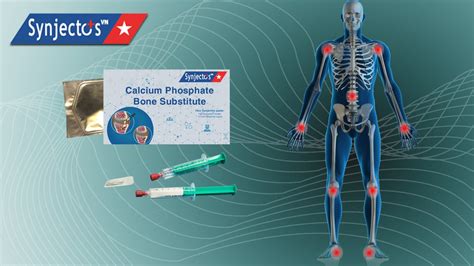We did not find results for: Produk - Synjectos