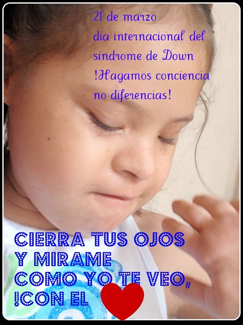 Mensajes dia mundial del sindrome de down. El Cuerpo Humano : El Síndrome de Down