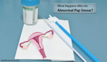 What Happens After An Abnormal Pap Smear By Dr Himanshi