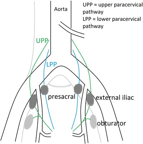 A Study On Uterine Lymphatic Anatomy For Standardization Of Pelvic