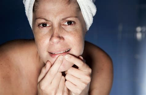 How Can I Remove Blackheads On My Face : Nose strips get a grip of the