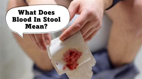 What Does Blood In Stool Mean Youtube