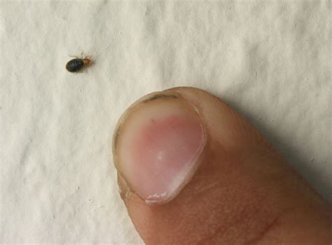 How To Get Rid Of Bed Bugs Step By Step Plan From Entomologists
