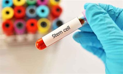 Stem Cell Transplant May Provide Cure For Aids Living Well Center