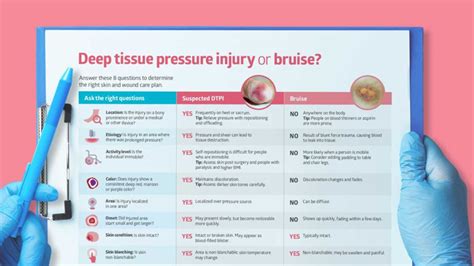 Deep Tissue Pressure Injury Vs Bruise Know The Differences