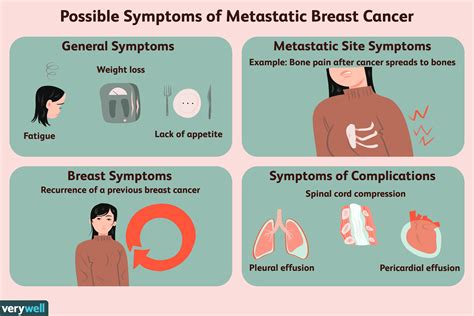 Symptoms Of Metastatic Bone Cancer Doctorvisit