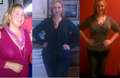 gastricsleeve wls beforeandafter after surgery wls beforeandafter 6 months weight loss
