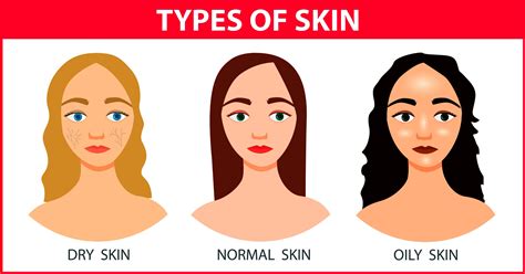 Complexion Types