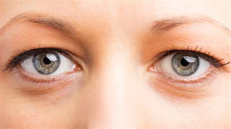 Hooded Eyes What Is It Causes And The Best Treatment