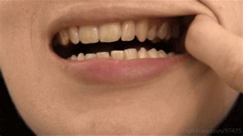 Miss M Dirty World Mouth Closeup And Uvula Inside Mouth Tonsils Uvula