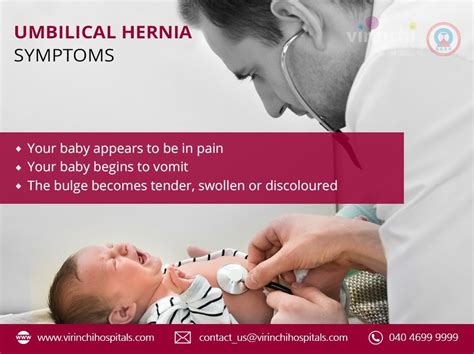 Umbilicalherniasymptoms Umbilical Hernia Hernia Symptoms Symptoms