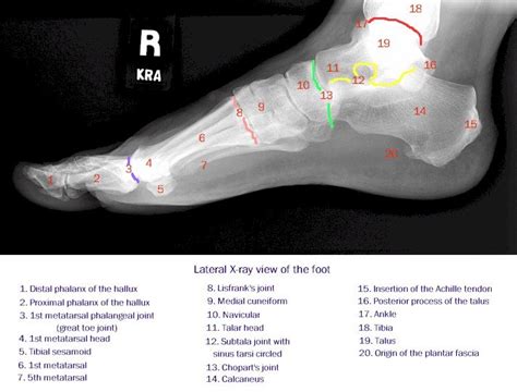 Foot Xray Anatomy