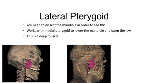 Medial And Lateral Pterygoid Plate Pterygoid Muscle Reconstruction